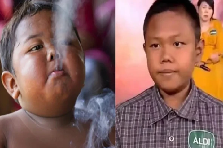 Menino que fumava 40 cigarros por dia e reapareceu aos 18 anos começou a fumar com 18 meses