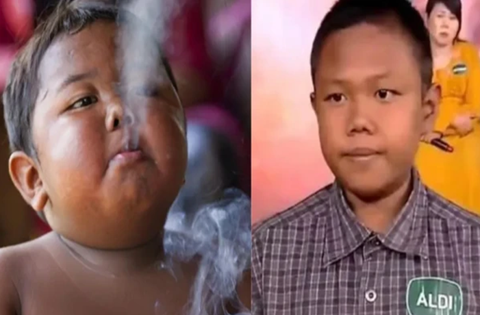 Menino que fumava 40 cigarros por dia e reapareceu aos 18 anos começou a fumar com 18 meses